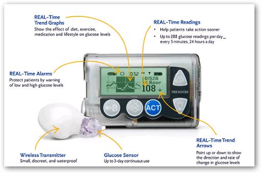 Medtronic Hits The Million Mark with Real Time insulin monitoring and ...